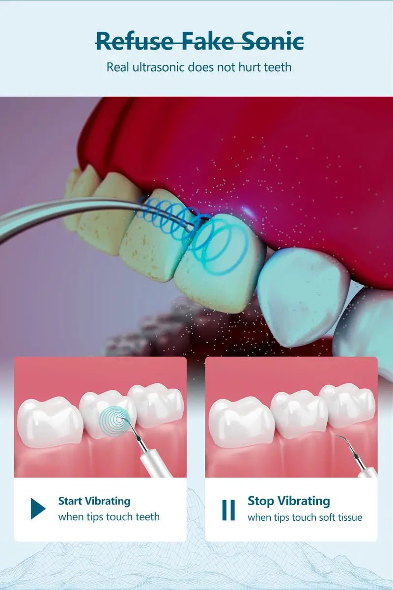 V34 Ultrasonic Irrigator Dental Scaler for Teeth Whitening & Cleanup - V34 Labs